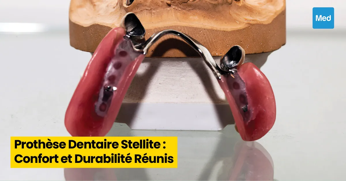 Prothèse Dentaire Stellite : Confort et Durabilité Réunis